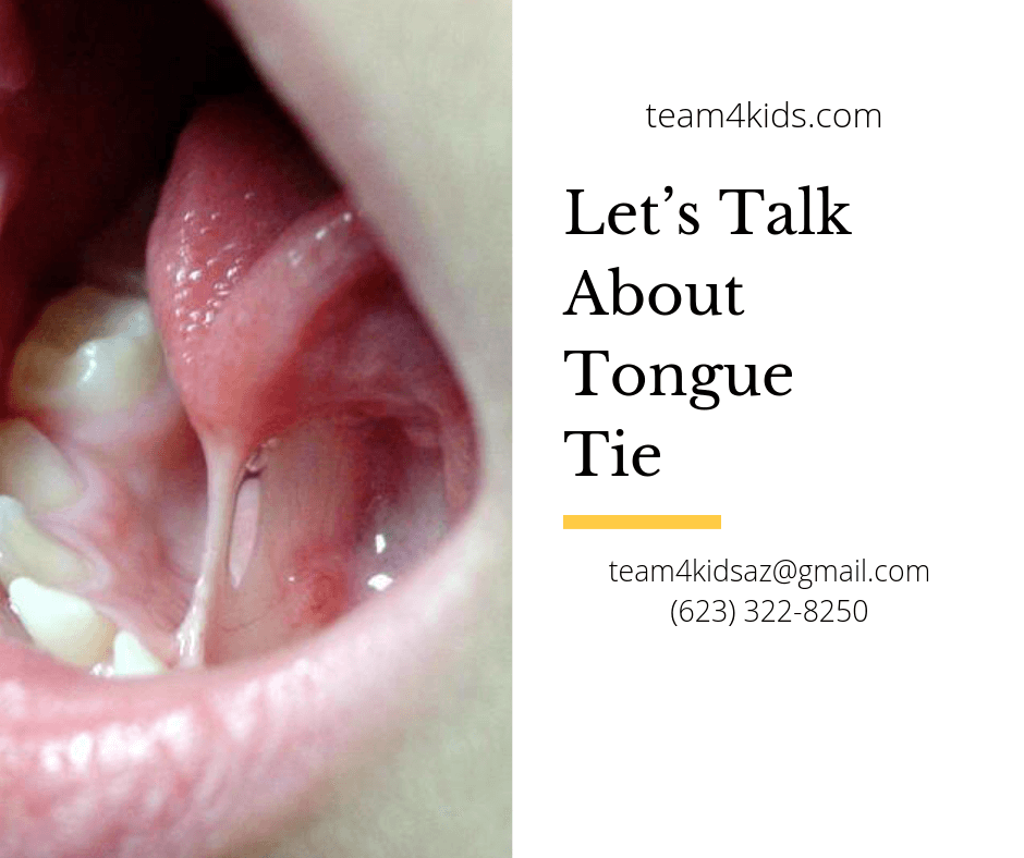 About Tongue Tie